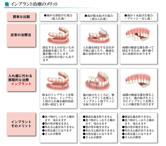 失った歯の修復法として、従来は人工クラウンやブリッジ、取り外し式の部分的な入れ歯、総入れ歯が利用されてきました。しかし、こうした代用物を口の中に確実に固定させるためには、隣の健康な歯を削らなければならないといった問題がありました。インプラントは、健康な歯を削ることなく噛める喜びと自然な外観や表情を取り戻すことができます。
